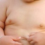 A solution for childhood obesity? Universal basic income